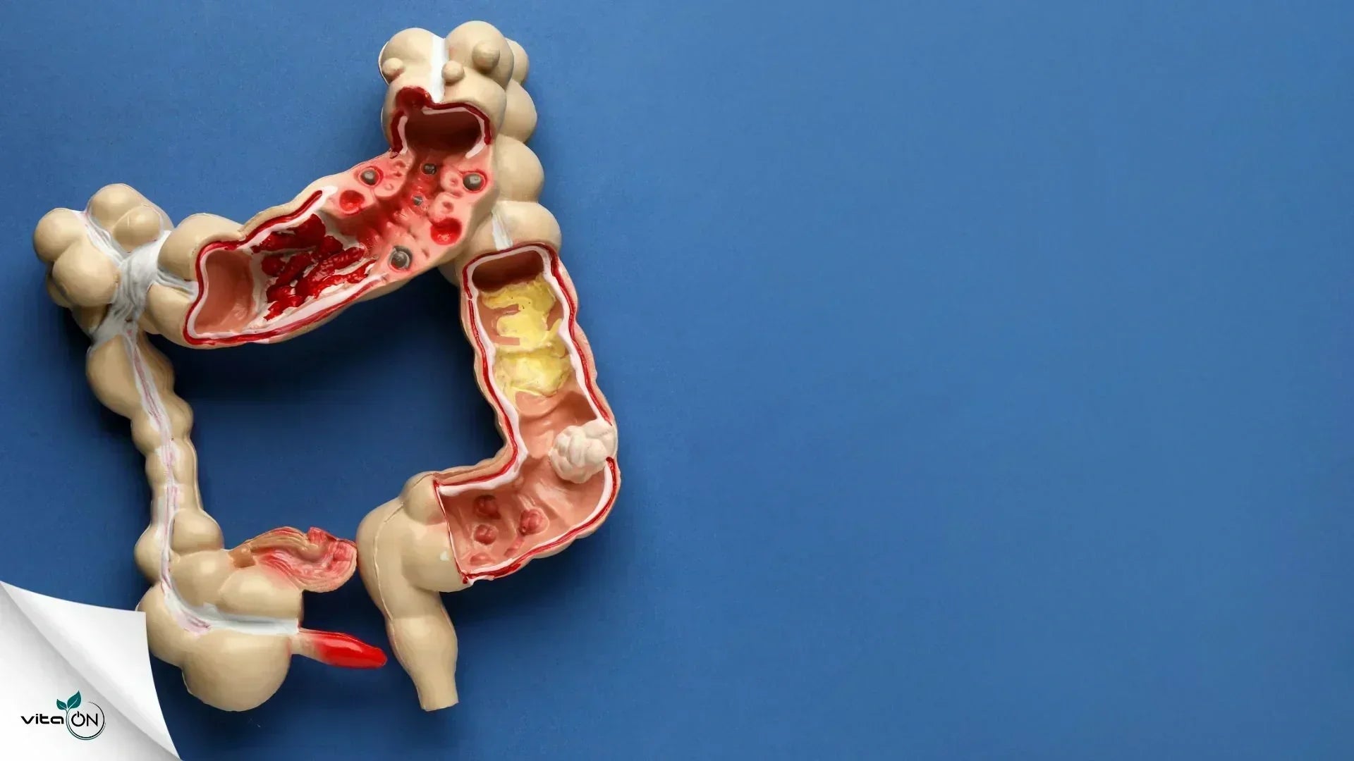 Устройство и функции на тънките и дебелите черва